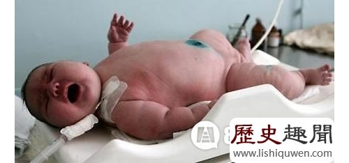 世界上最小的嬰兒竟然這麼小