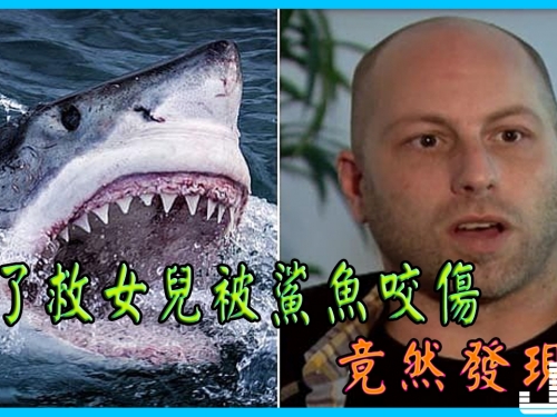 他為了救女兒「被鯊魚撕裂背部」，但「醫生竟然要他感謝那條鯊魚」