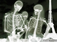 12張奇妙的人體X光片顛覆你的審美觀！抱小孩那一張實在太震驚了！