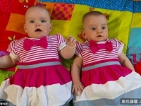 奇！這一對雙胞胎　生日相差2個月