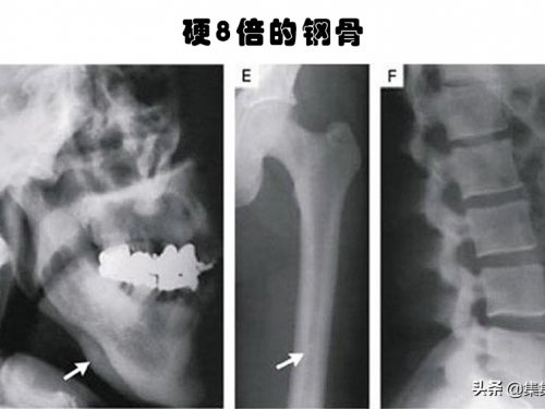 罕見的身體特徵：只有少數人身上才擁有的10個罕見的特徵