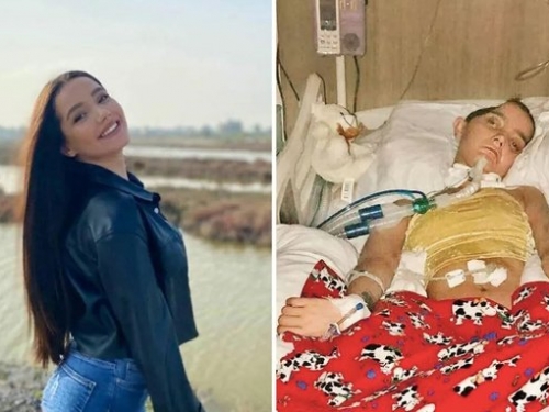 正妹沒戴安全帽出車禍 開刀切掉半顆頭 驚悚對比照曝