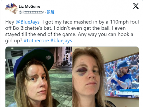 MLB》遭177公里界外球K中臉 藍鳥女球迷「破相照」讓球迷看傻