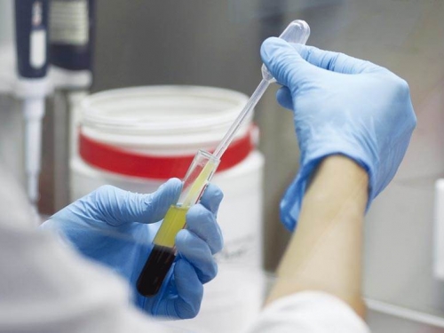 比瑞德西韋更強？醫曝奎寧抗肺炎數據驚人