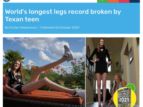 1米35！美國17歲少女打破世界女性最長腿紀錄！（圖）