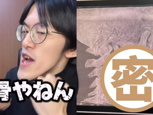 網紅「世界最長下巴」X光照出爐！醫師也看呆：獨一無二