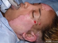 女孩刺青了半張臉，只是想看起來正常