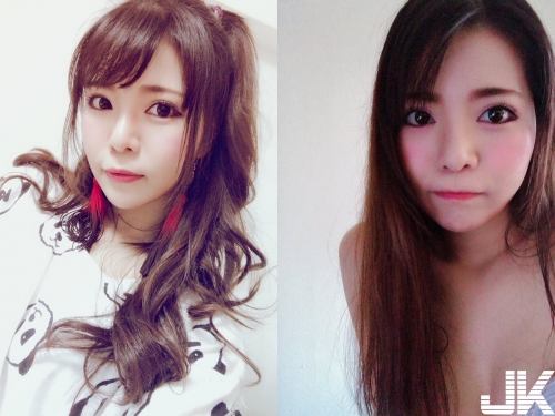 SOD女優「私密處整形」名器化　醫生掛保證：會宛如黑洞般從內部收縮