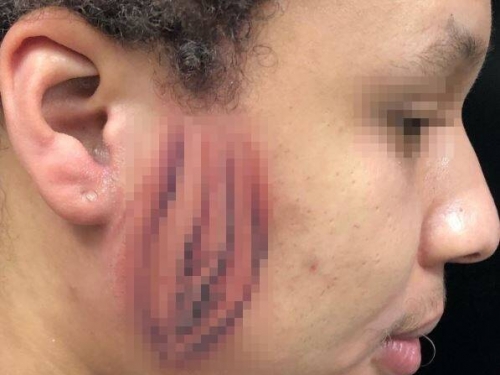 勸阻無效！他要求「女性陰部」刺臉上 刺青師超狂成果曝光