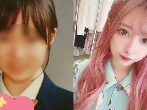 17 歲告白被拒...櫻花妹狠砸 169 萬「全臉動刀」變正妹！網驚：好像「橋本有菜」