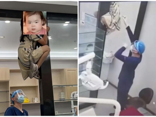 不想看牙醫！女童爬到診間門框上「無尾熊式緊抓不放」 網笑：下次麻藥打腿上