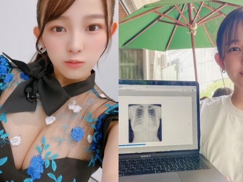 不忍了！「I 級身材」總被質疑是假的　女星「天木純」曬 X 光片打臉網友