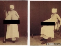 醫療史上的變形病例，還會令人不安嗎