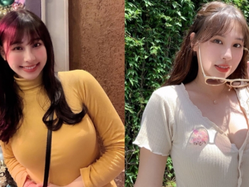 「上圓牙醫」真奶乳型超碩大，甜美笑顏惹網友狂讚：「我需要根管！」
