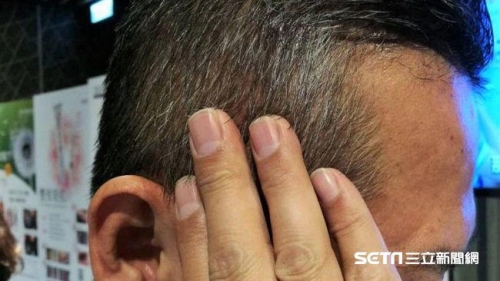 長白髮代表變老？最新研究揭密：恐怕是身體在抗癌