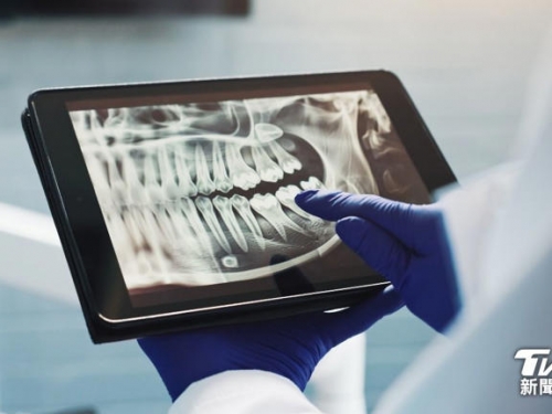 日研究找出「牙齒再生」關鍵幹細胞 缺牙未來有望長出真牙