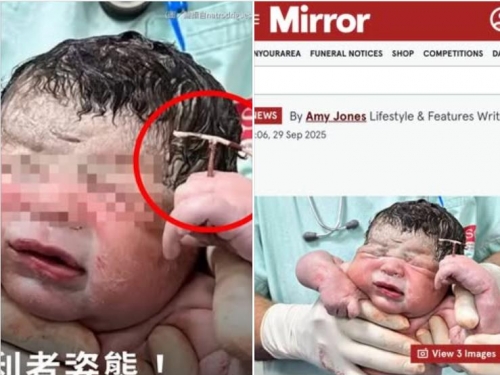 最強男嬰全球暴紅「手握避孕器」出生