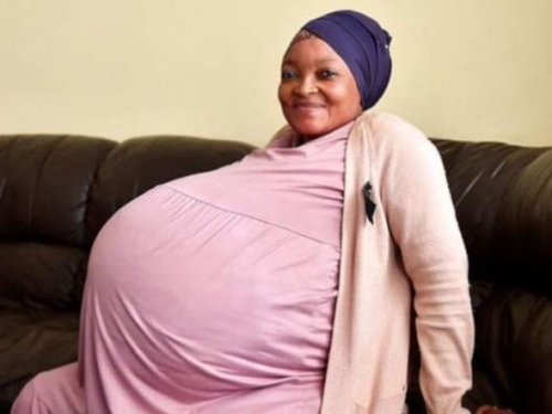 她挺「超大巨肚」到醫院生產 剖腹一開竟有10胞胎