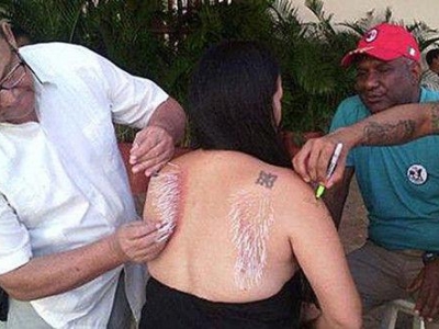 女子後背被人插入「2500根針」似刺蝟，卻毫無反抗，沒想到原因竟然是...，太恐怖了！！