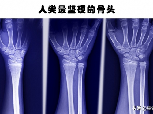 超級強大的力量？堅硬的骨骼？這7種獨特的身體特徵僅少數人擁有