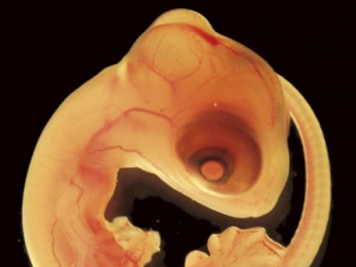 住在腦中的寄生蟲
