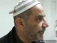 伊拉克大叔被機槍子彈擊中頭部　仍奇蹟生還！
