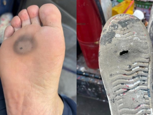 烈日下幹活！工地妹子腳底突刺痛「瞬間黑一塊」：鞋融化了